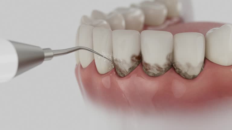 Reliable Dental contractor in Acton, CA by Smile Center Dentistry